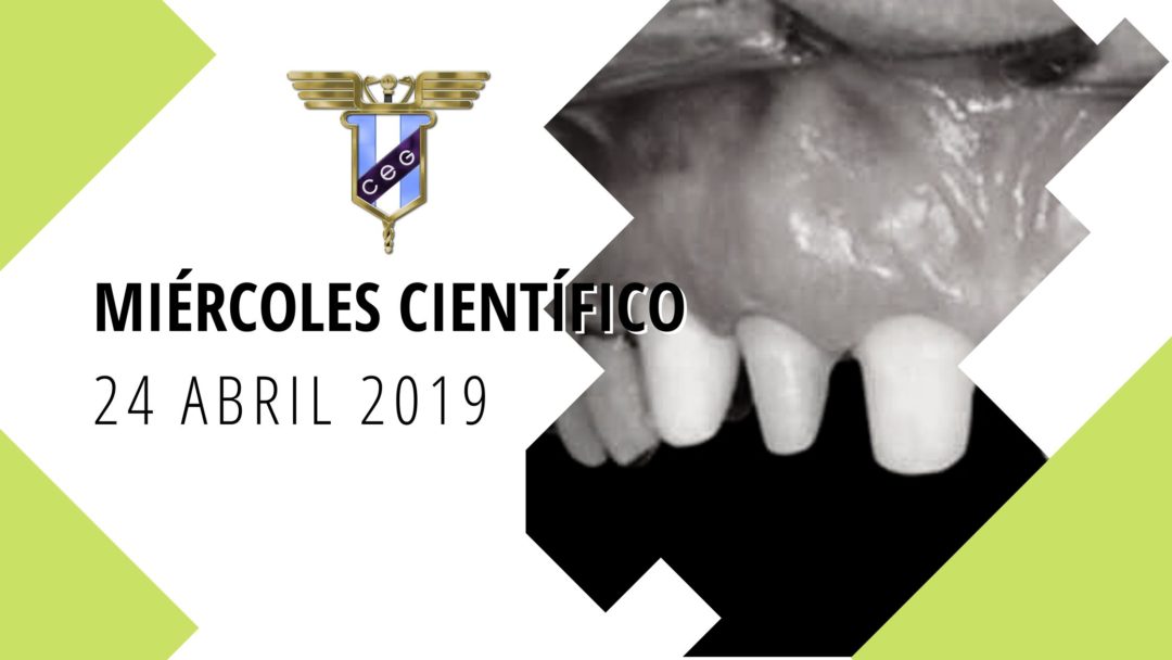Miércoles Científico: Elevación de Seno Maxilar” y “Opciones terapéuticas en dientes estructuralmente comprometidos en Endodoncia”